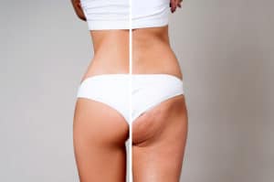 rueckenansicht weiblicher koerper - kosmetik-studio - stuttgart - carola kiesel - beauty-balance